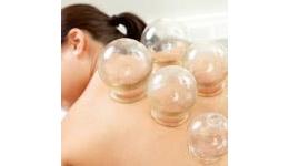 Cupping Supplies & Accessories