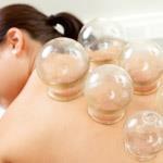 Cupping Supplies & Accessories Cupping Supplies & Accessories