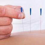 Needles, Ear Seeds & Tacks