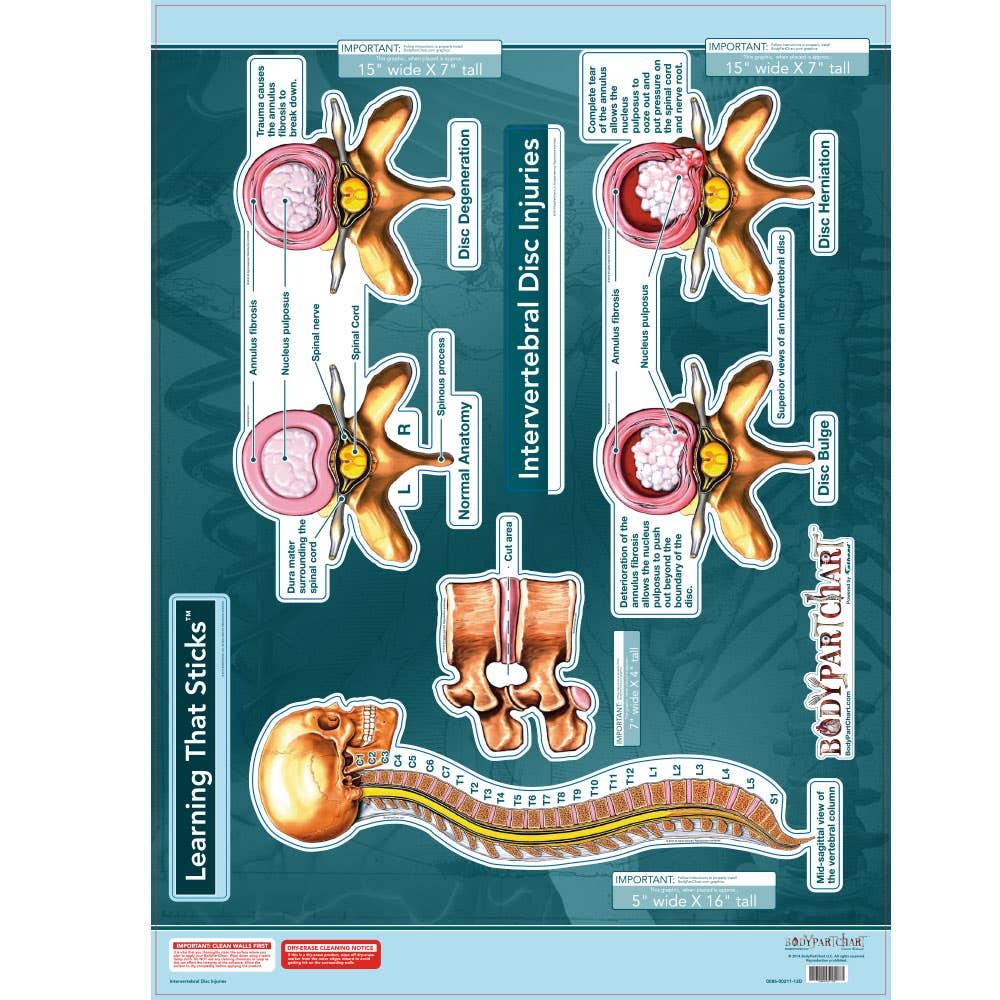 BodypartchartIntervertebralDiscInjuries