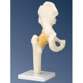 American 3b Scientific Hip Joint Model