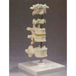 Vertebrae