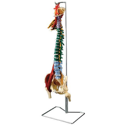 MuscleSpineWithDisordersWithStand