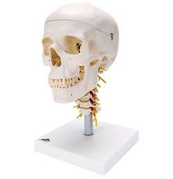 Skull On Cervical Spine - 4 Part