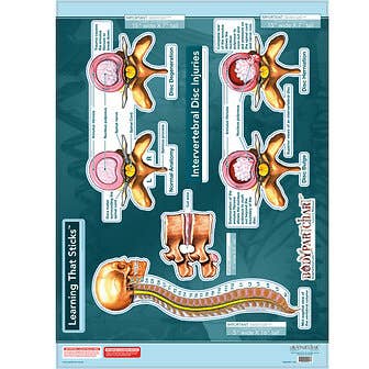 Bodypartchart Intervertebral Disc Injuries